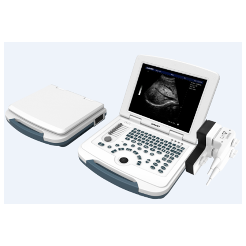 Basic Laptop BW Ultrasound Scanner Pemindai ultrasound doppler 2D Cina mesin gema pemindai ultrasound portabel