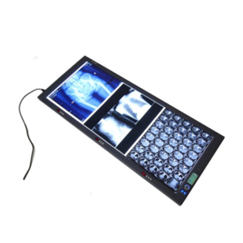 Negatoscopio dental con pantalla Digital para visor de películas médicas de hospital, caja de visor de películas médicas de rayos x doble led